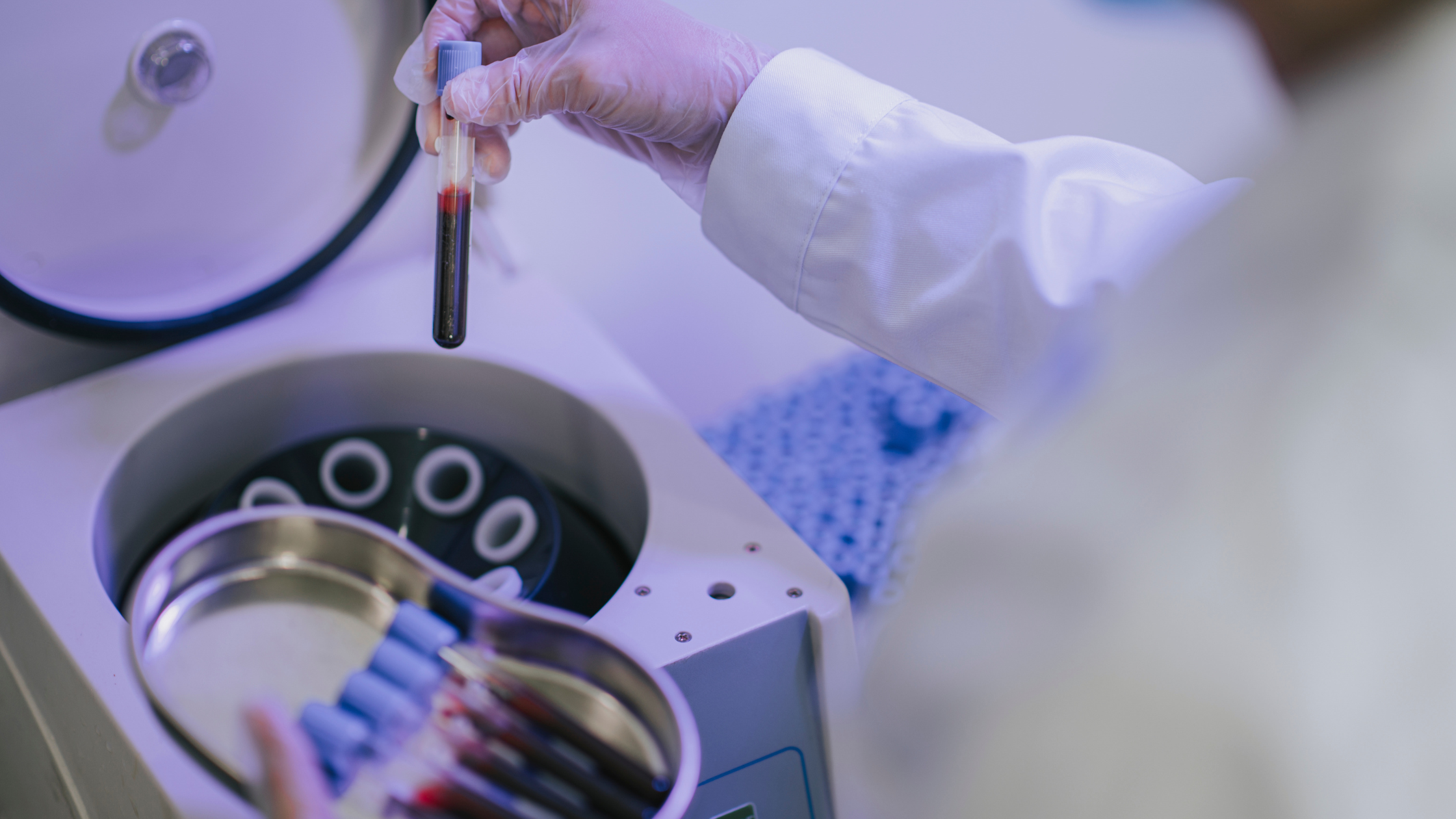 PRP therapy for musculoskeletal conditions