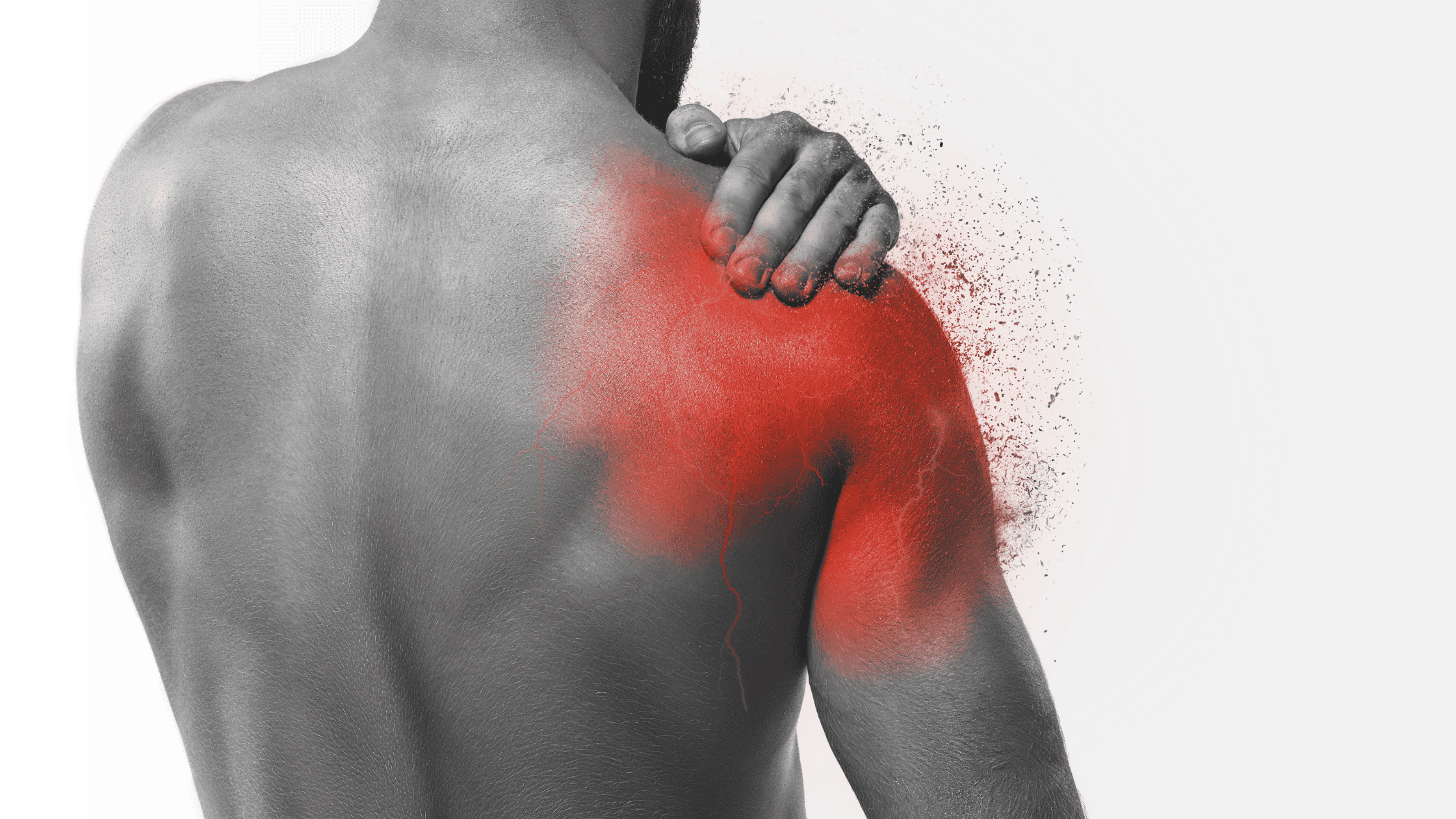 suprascapular nerve blocks